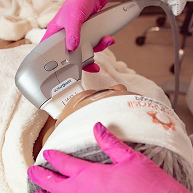 Mulher fazendo tratamento estético com Ultraformer 3 - site Dra. Sarah Brasil dermatologista especialista em estética corporal e facial