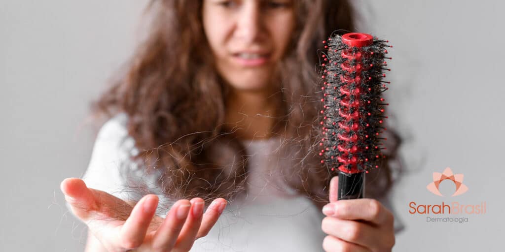 Mulher com escova olhando a mão sentindo a queda de cabelo site Dra. Sarah Brasil Dermatologista