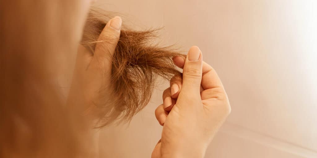 Mulher pegando no cabelo sentido a queda de cabelo site Dra. Sarah Brasil Dermatologista